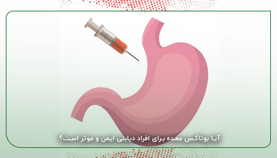 آیا بوتاکس معده برای افراد دیابتی ایمن و موثر است؟