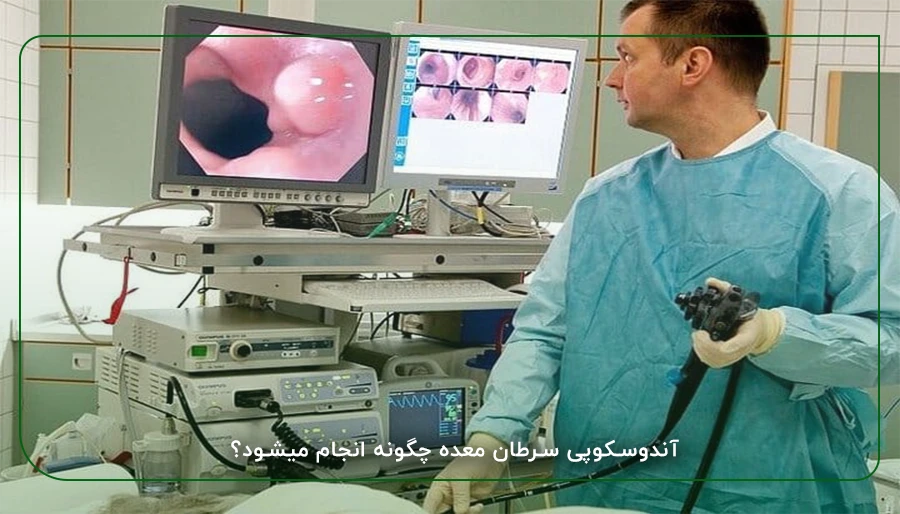 آندوسکوپی سرطان معده چگونه انجام میشود؟