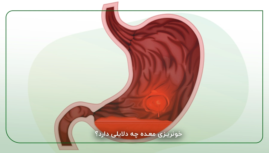خونریزی معده چه دلایلی دارد؟