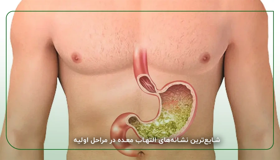 شایع_ترین نشانه_های التهاب معده در مراحل اولیه