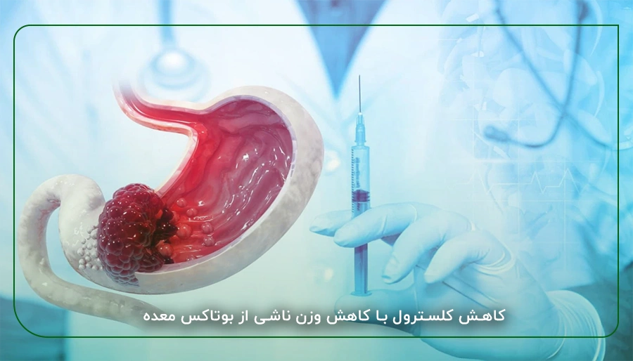 کاهش کلسترول با کاهش وزن ناشی از بوتاکس معده