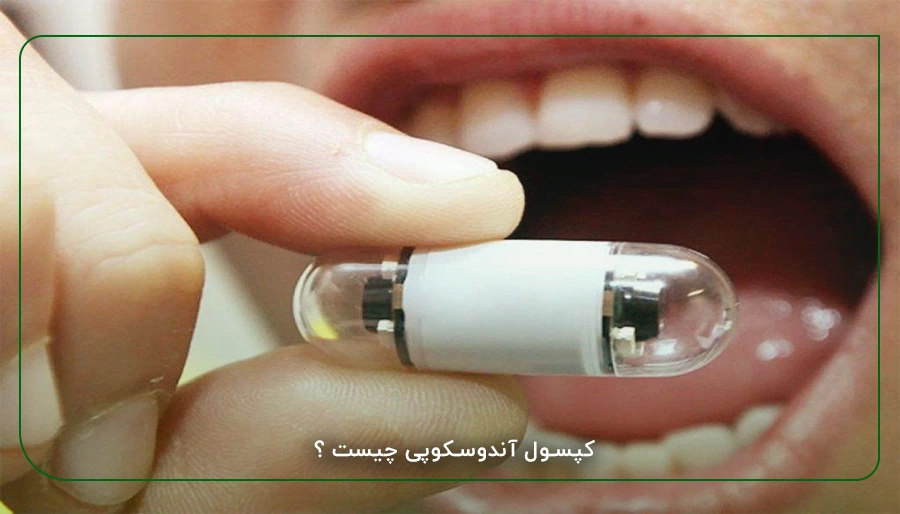 کپسول آندوسکوپی چیست ؟