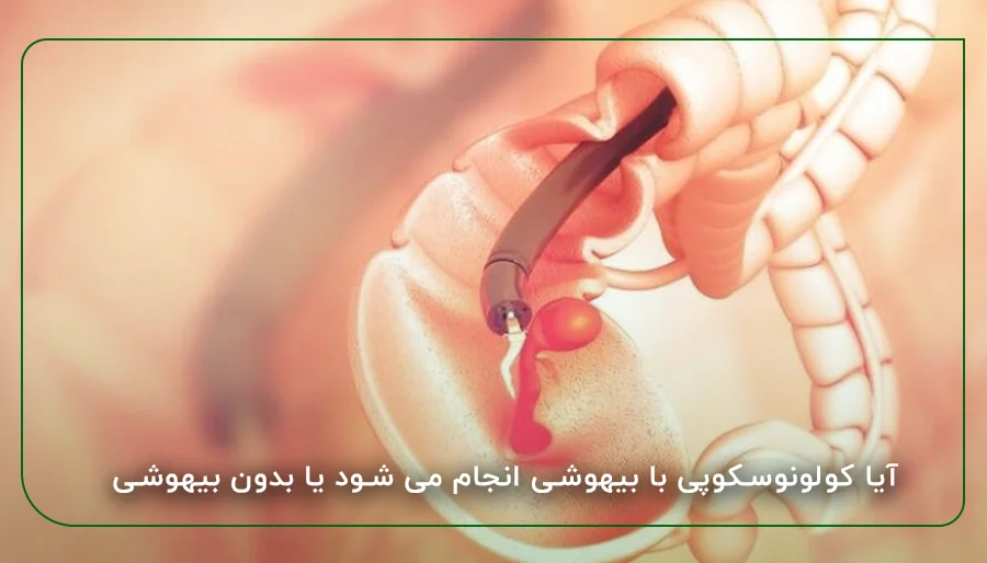 آیا کولونوسکوپی با بیهوشی انجام می شود یا بدون بیهوشی