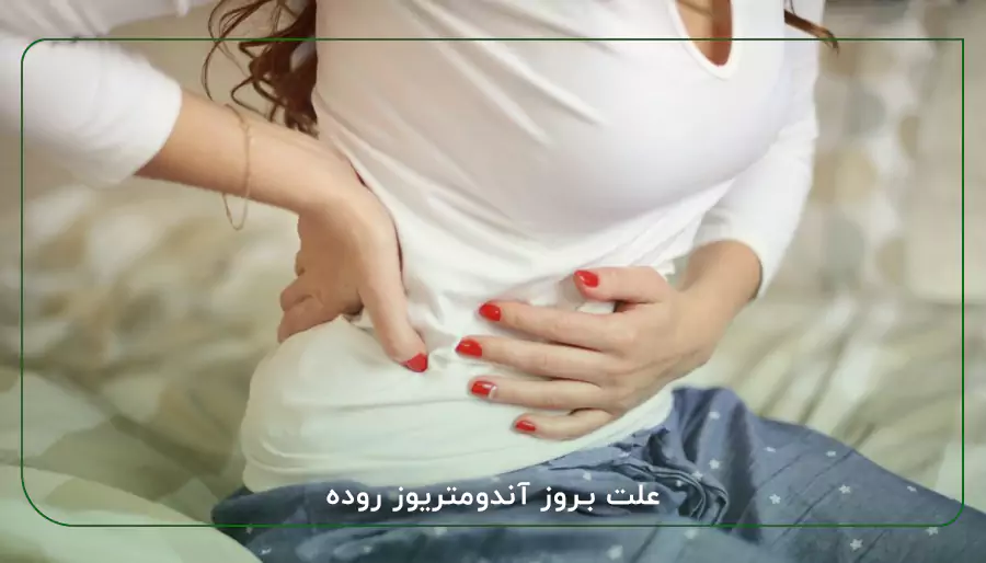 علت بروز آندومتریوز روده