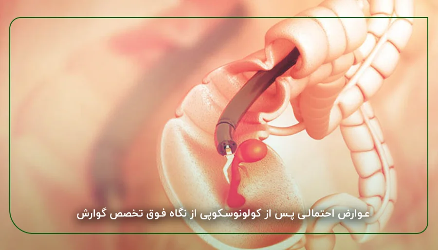 عوارض کولونوسکوپی​