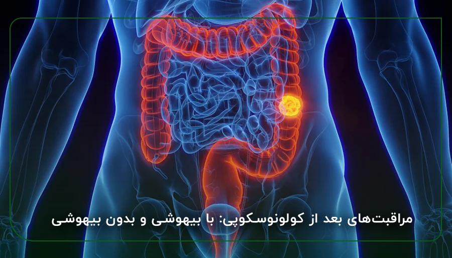 مراقبت‌های بعد از کولونوسکوپی