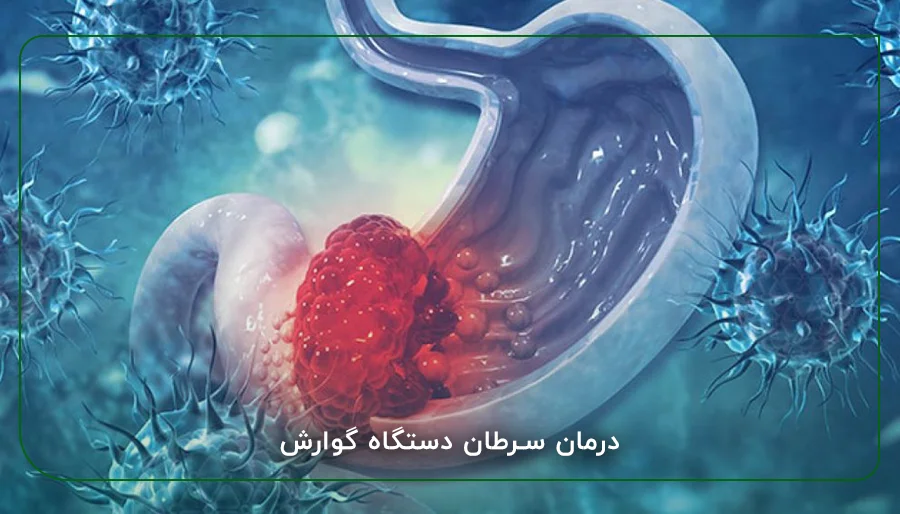 درمان سرطان دستگاه گوارش
