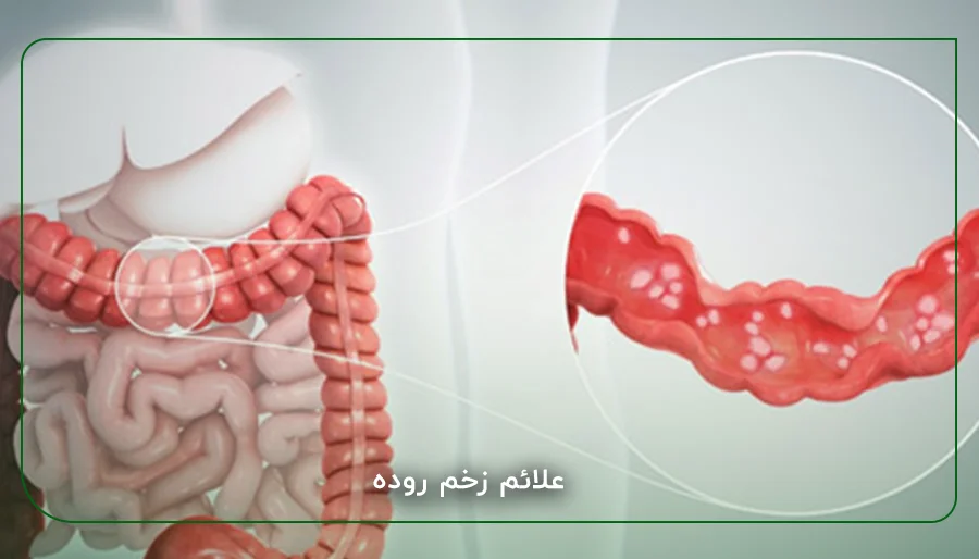 علائم زخم روده