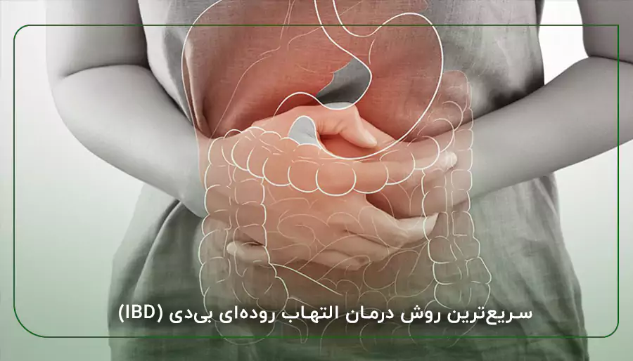 سریع‌ترین روش درمان التهاب روده‌ای بی‌دی (IBD)