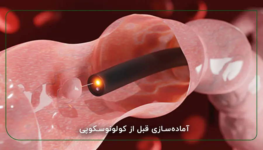 آماده‌سازی قبل از کولونوسکوپی