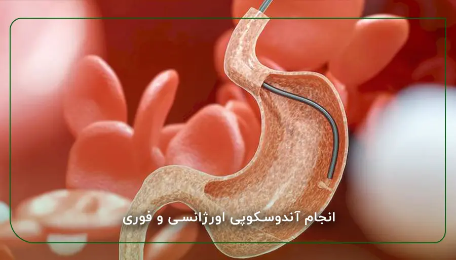 انجام آندوسکوپی اورژانسی و فوری​
