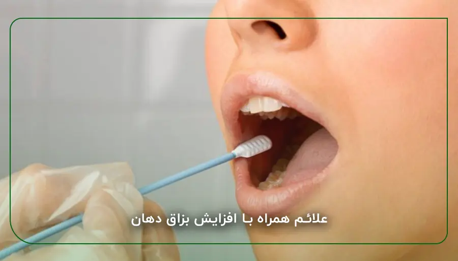 علائم همراه با افزایش بزاق دهان