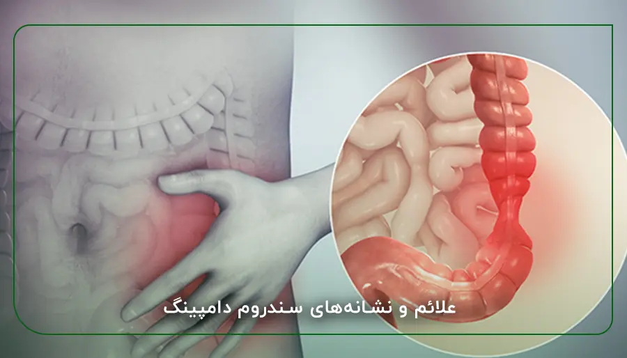 علائم و نشانه‌های سندروم دامپینگ