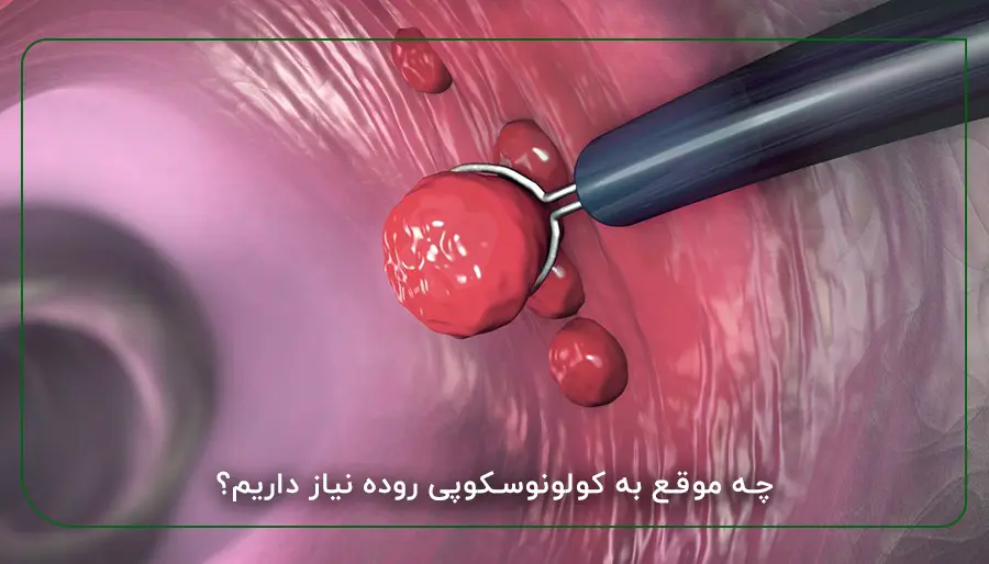 چه موقع به کولونوسکوپی روده نیاز داریم؟